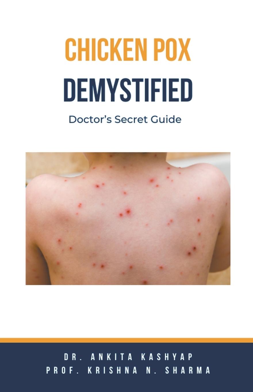 Knjiga Chickenpox Demystified Krishna N. Sharma