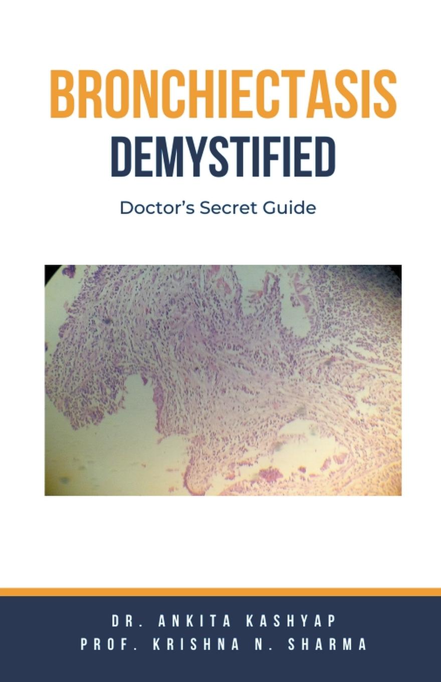 Knjiga Bronchiectasis Demystified Krishna N. Sharma