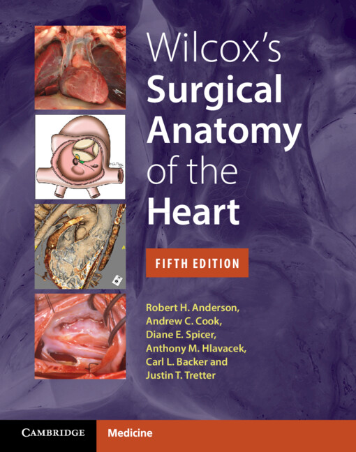 Buch Wilcox's Surgical Anatomy of the Heart Robert H. Anderson