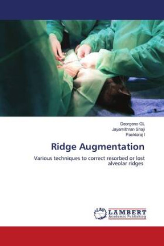 Knjiga Ridge Augmentation Jayamithran Shaji