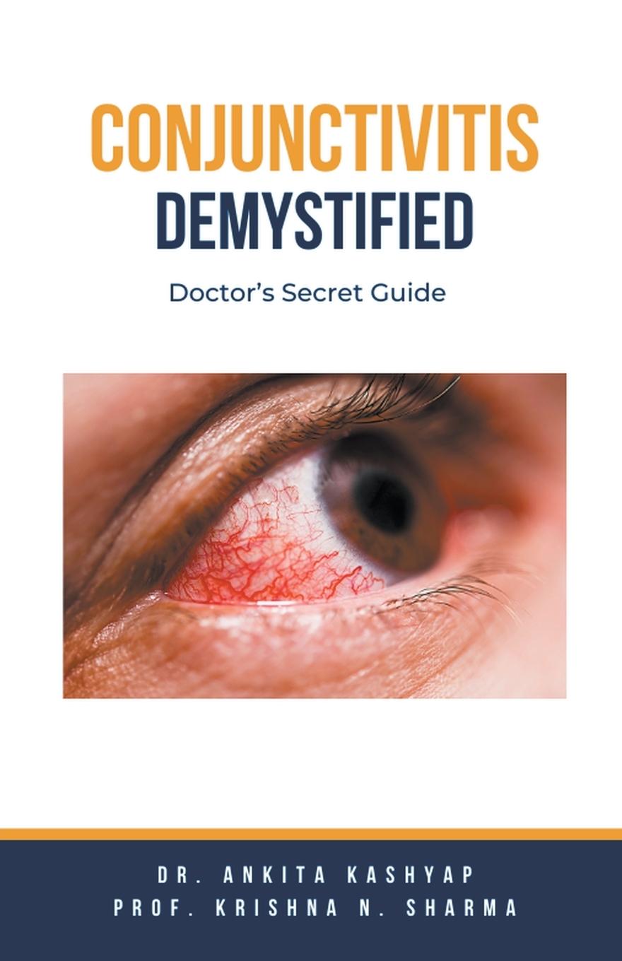 Knjiga Conjunctivitis Demystified Krishna N. Sharma