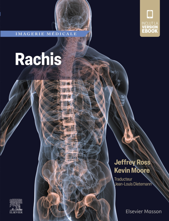 Книга Imagerie médicale : Rachis Jeffrey Ross