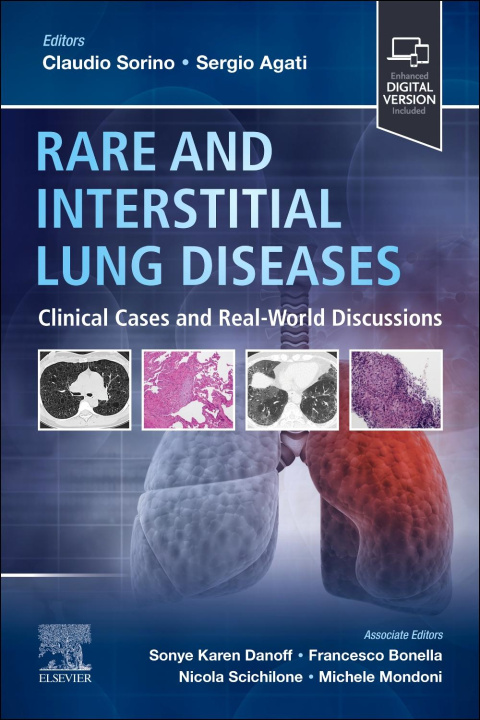 Buch Rare and Interstitial Lung Diseases Claudio Sorino