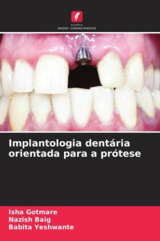 Książka Implantologia dentária orientada para a prótese Isha Gotmare