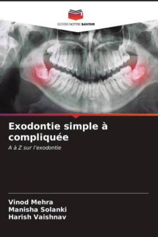 Carte Exodontie simple ? compliquée Manisha Solanki