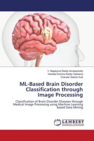 Knjiga ML-Based Brain Disorder Classification through Image Processing V. Nagarjuna Reddy Annapareddy