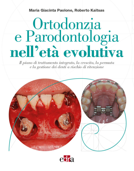 Kniha Ortodonzia e parodontologia nell'età evolutiva. Il piano di trattamento integrato, la crescita, la permuta e la gestione dei denti a rischio di ritenz Maria Giacinta Paolone