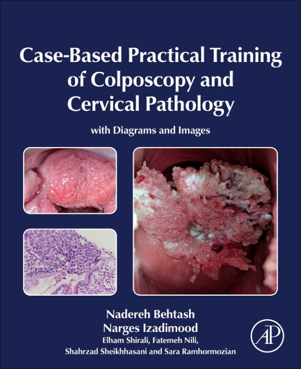 Carte Case-Based Practical Training of Colposcopy and Cervical Pathology Nadereh Behtash