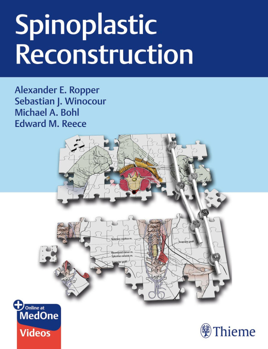 Книга Spinoplastic Reconstruction Sebastian Winocour