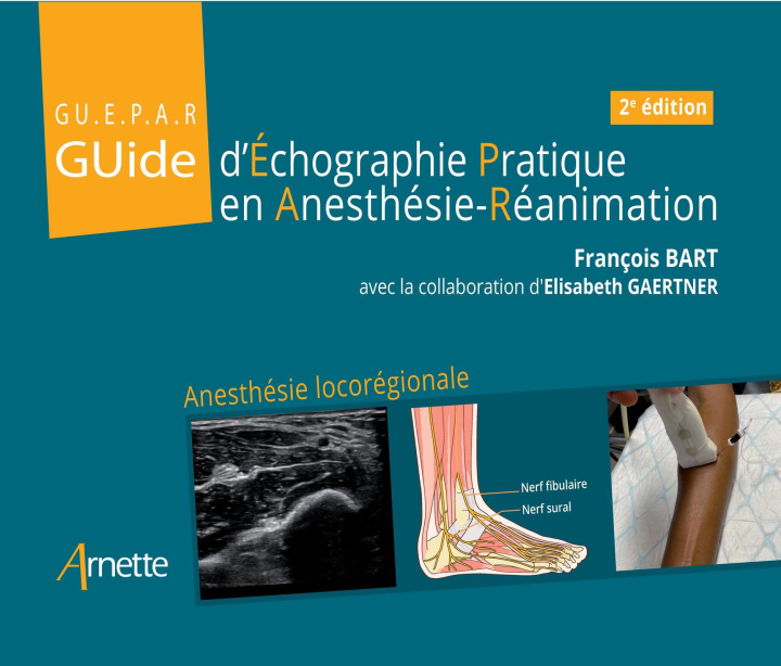 Книга Guide d'Échographie Pratique en Anesthésie-Réanimation (GUEPAR) Gaertner