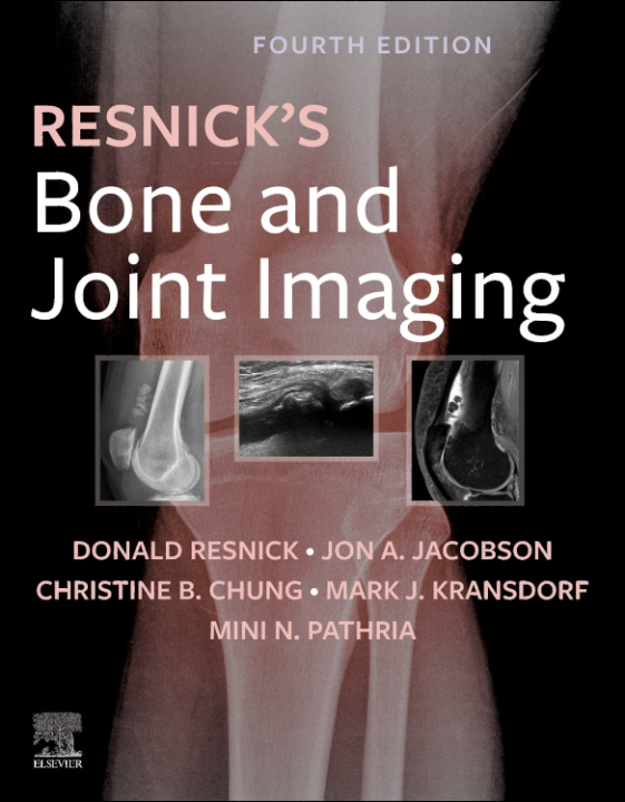 E-kniha Bone and Joint Imaging E-Book Donald L. Resnick