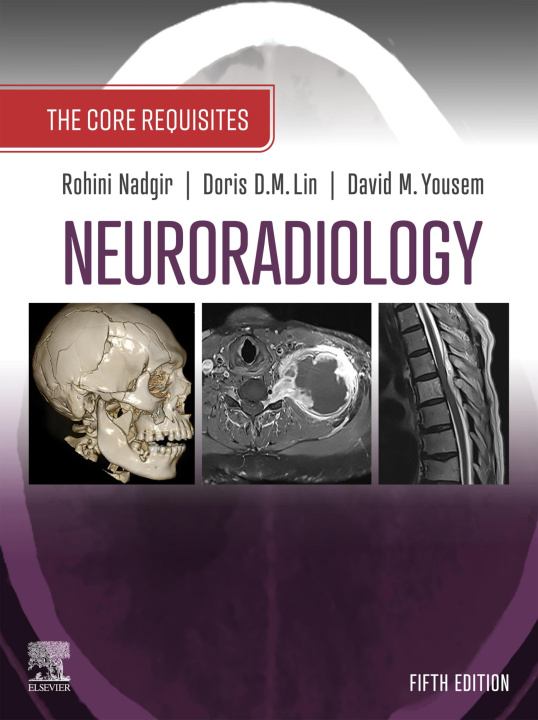 E-book Neuroradiology: The Requisites E-Book Rohini Nadgir