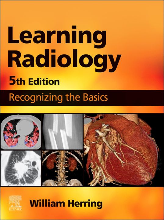 E-book Learning Radiology E-Book William Herring