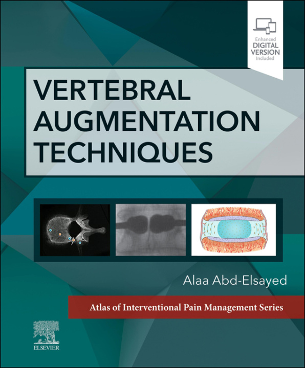 E-book Vertebral Augmentation Techniques Alaa Abd-Elsayed