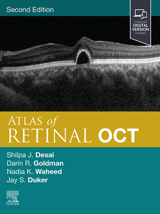 E-Book Atlas of Retinal OCT: Optical Coherence Tomography Jay S. Duker