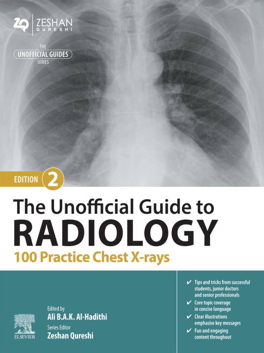 Libro electrónico Unofficial Guide to Radiology: 100 Practice Chest X-rays - E-Book Ali B.A.K. Al-Hadithi