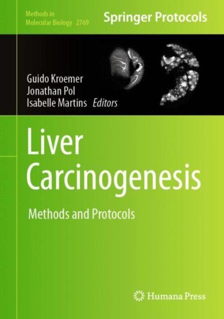 E-kniha Liver Carcinogenesis Guido Kroemer