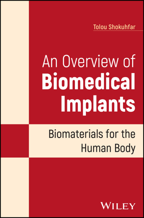 Livre Overview of Biomedical Implants: Biomaterials f or the Human Body 