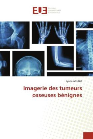Knjiga Imagerie des tumeurs osseuses bénignes Lynda Aoudia