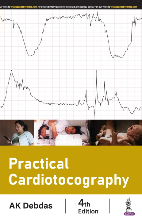 Knjiga Practical Cardiotocography AK Debdas