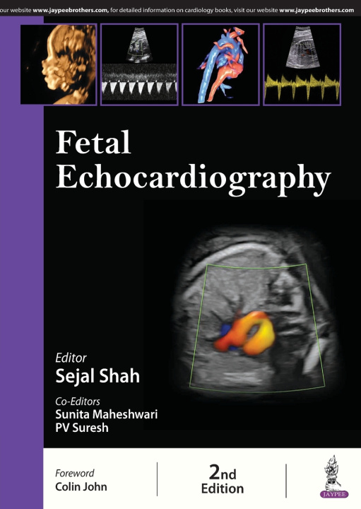 Книга Fetal Echocardiography Sejal Shah