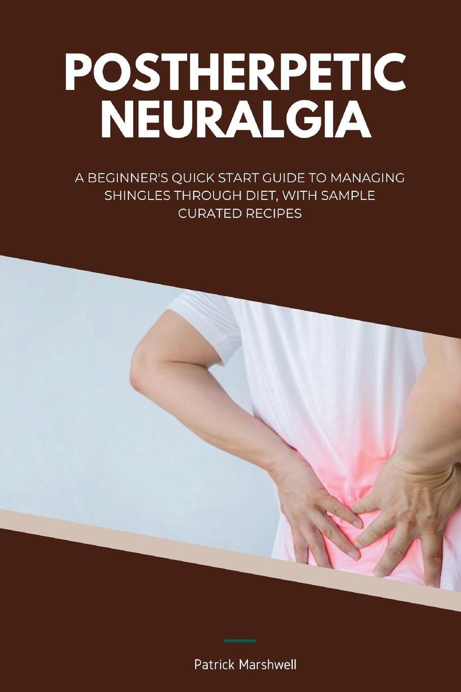 Knjiga Postherpetic Neuralgia Patrick Marshwell