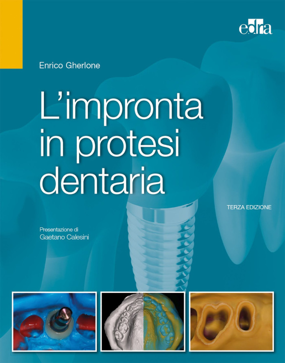 Книга impronta in protesi dentaria Enrico F. Gherlone