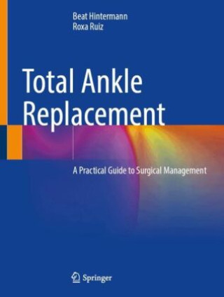 Book Total Ankle Replacement Beat Hintermann