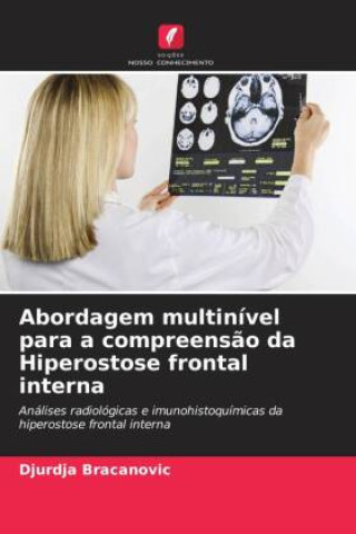 Book Abordagem multinível para a compreensão da Hiperostose frontal interna Djurdja Bracanovic