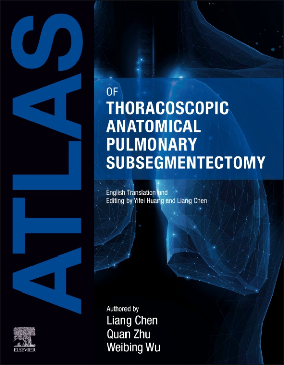 Carte Atlas of Thoracoscopic Anatomical Pulmonary Subsegmentectomy Liang Chen
