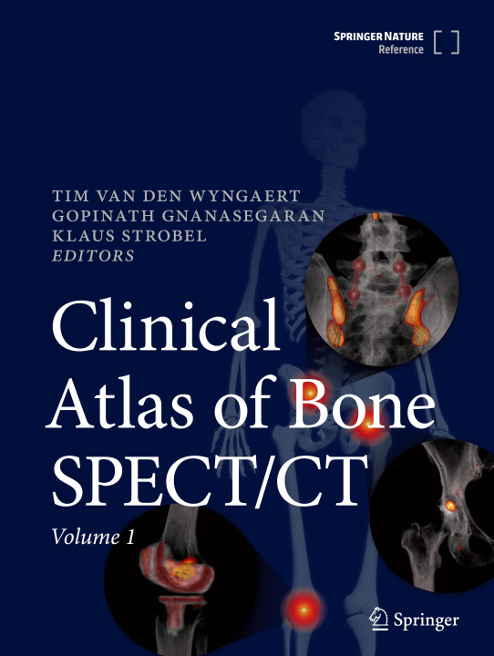 Carte Clinical Atlas of Bone SPECT/CT Klaus Strobel