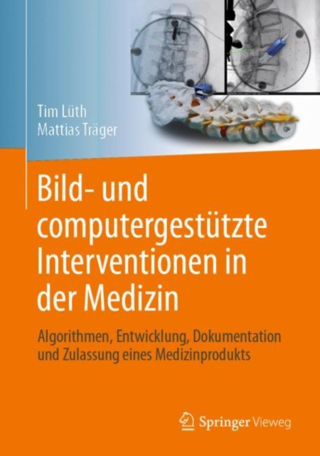 E-kniha Bild- und computergestutzte Interventionen in der Medizin Tim Christian Luth