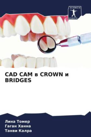 Książka CAD CAM w CROWN i BRIDGES Gagan Hanna