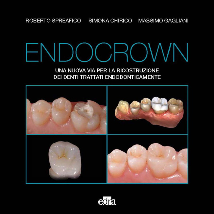 Carte Endocrown. Una nuova via per la ricostruzione dei denti trattati endodonticamente Roberto Spreafico