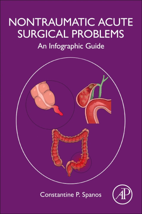 Knjiga Non-Traumatic Acute Surgical Problems Constantine P. Spanos