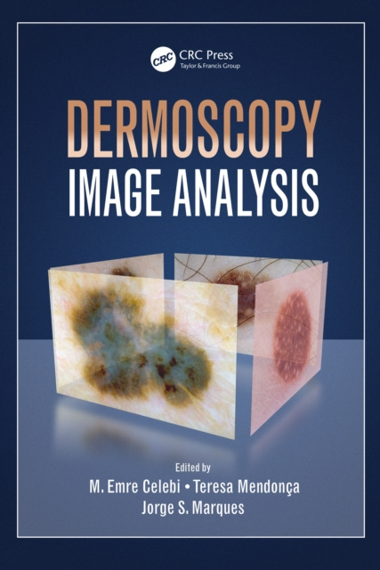 E-knjiga Dermoscopy Image Analysis M. Emre Celebi