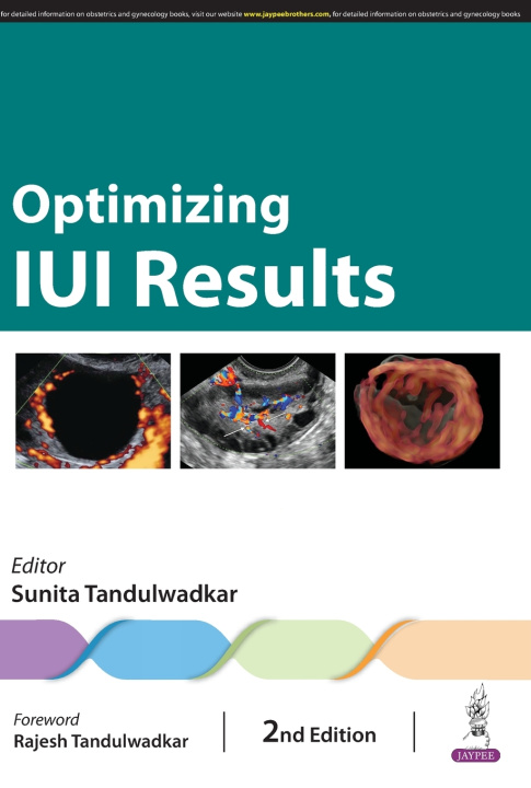 Knjiga Optimizing IUI Results Sunita Tandulwadkar