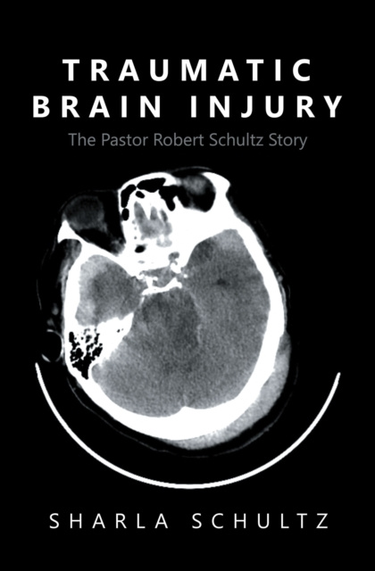 E-knjiga Traumatic Brain Injury Sharla Schultz