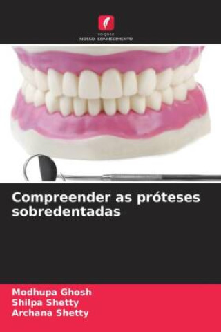 Book Compreender as próteses sobredentadas Modhupa Ghosh