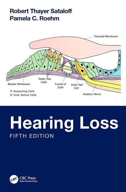 Libro Hearing Loss Robert Thayer Sataloff