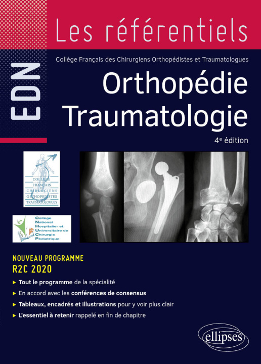 Kniha Orthopédie Traumatologie Collège Français des Chirurgiens Orthopédistes et Traumatologues