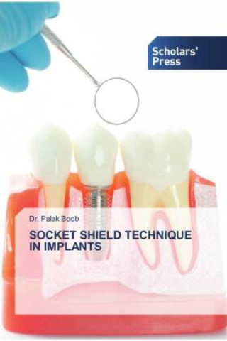 Knjiga SOCKET SHIELD TECHNIQUE IN IMPLANTS Dr. Palak Boob