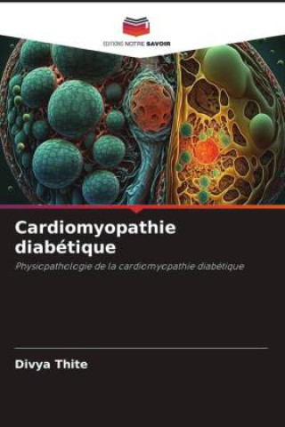 Carte Cardiomyopathie diabétique Divya Thite