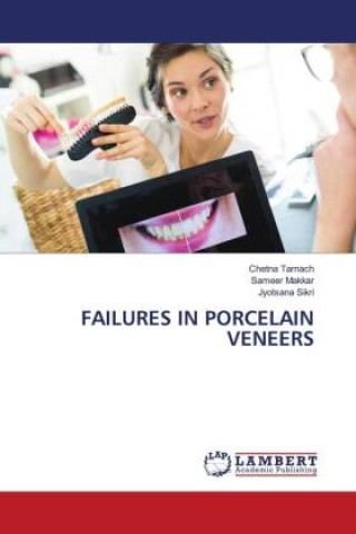 Knjiga FAILURES IN PORCELAIN VENEERS Sameer Makkar