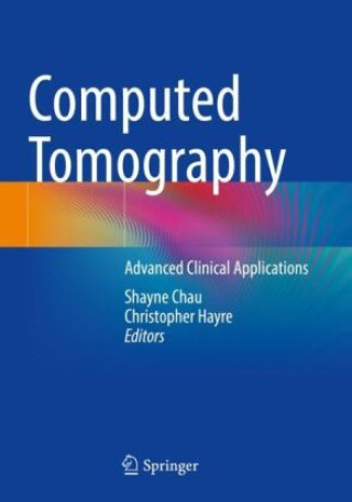 Książka Computed Tomography Shayne Chau