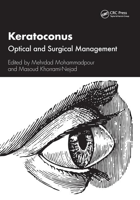 Book Keratoconus Mehrdad Mohammadpour