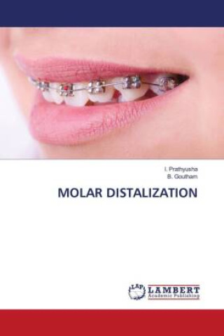 Kniha MOLAR DISTALIZATION B. Goutham
