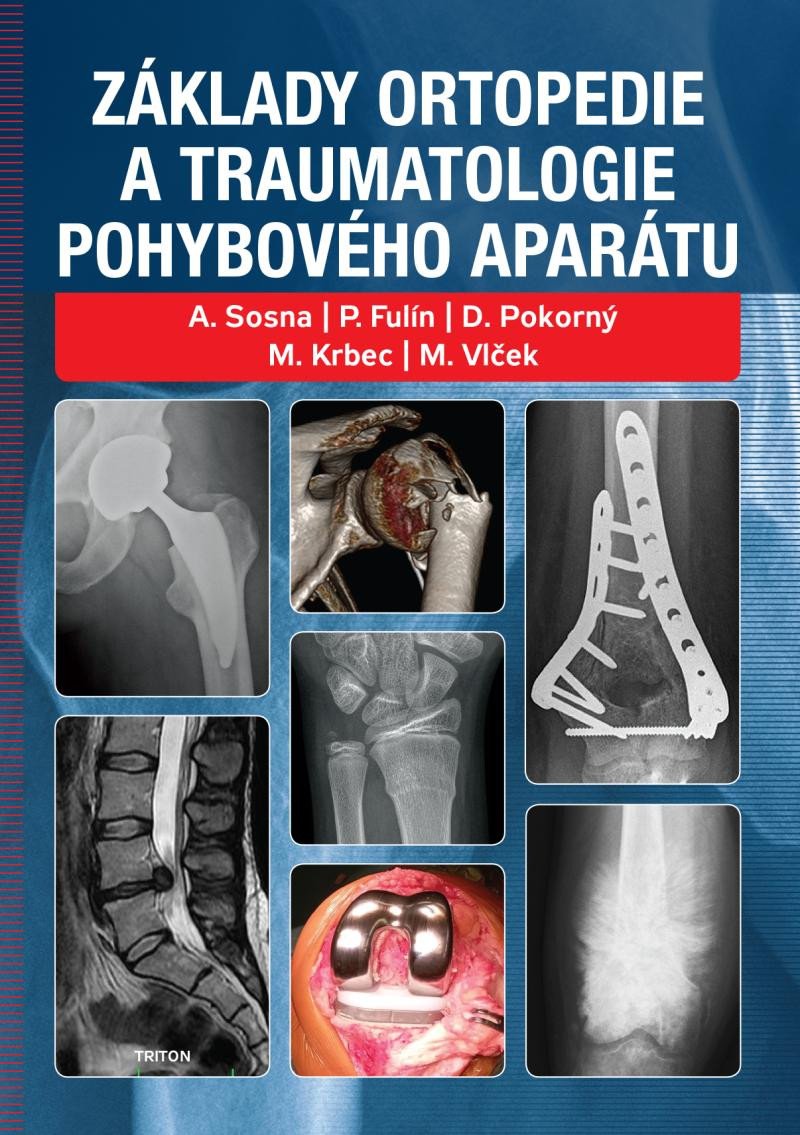 Książka Základy ortopedie a traumatologie pohybového aparátu Antonín Sosna