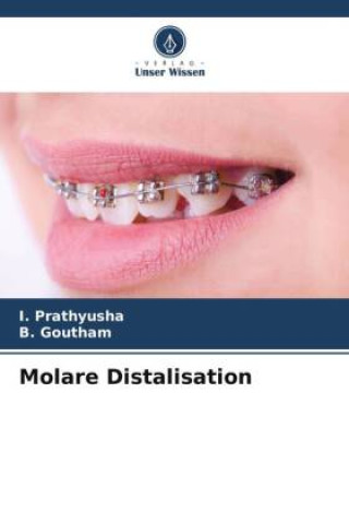 Book Molare Distalisation I. Prathyusha