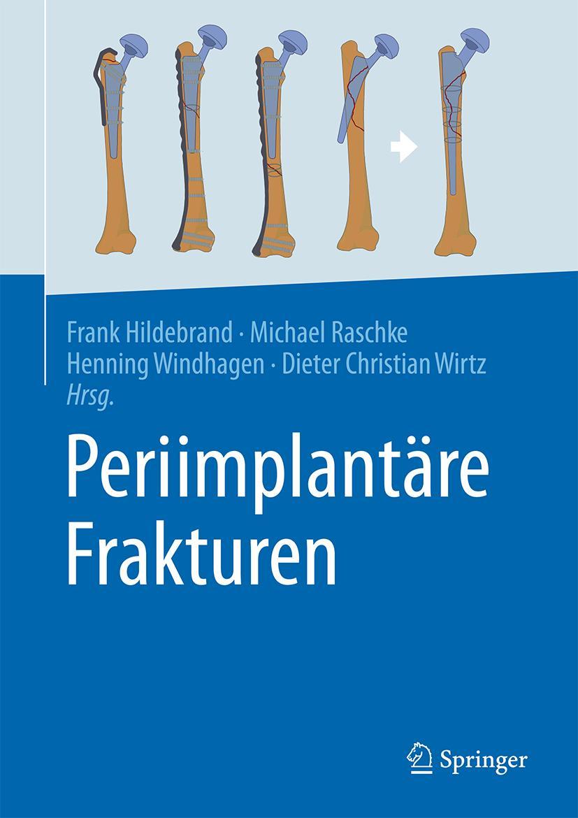 Kniha Periimplantäre Frakturen Michael Raschke